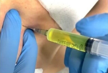 Врач делает внутримышечную инъекцию